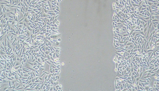 细胞划痕实验